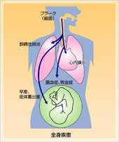 全身疾患との関係